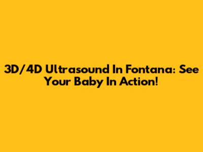 3D/4D Ultrasound In Fontana: See Your Baby In Action!