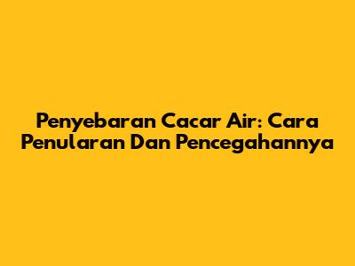Penyebaran Cacar Air: Cara Penularan Dan Pencegahannya