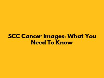 SCC Cancer Images: What You Need To Know