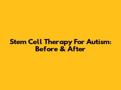 Stem Cell Therapy For Autism: Before & After