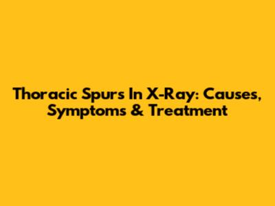 Thoracic Spurs In X-Ray: Causes, Symptoms & Treatment