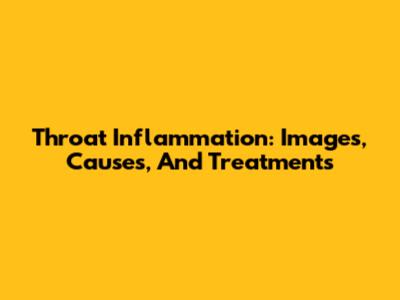 Throat Inflammation: Images, Causes, And Treatments