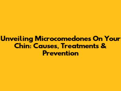Unveiling Microcomedones On Your Chin: Causes, Treatments & Prevention
